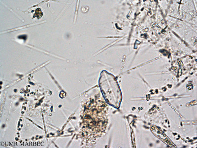 phyto/Scattered_Islands/all/COMMA April 2011/Petroneis monilifera (ancien Mastogloia sp -1)(copy)_thumb.jpg